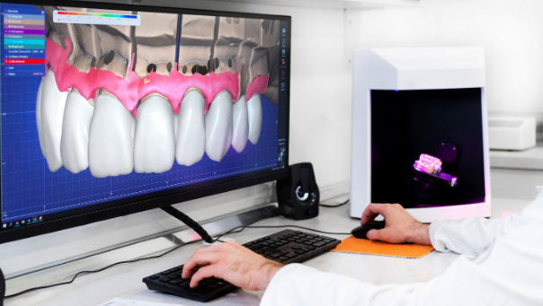 Digitale Technologie im zahntechnischen Labor = ein Tool zur Vereinfachung der digitalen Zahnmedizin