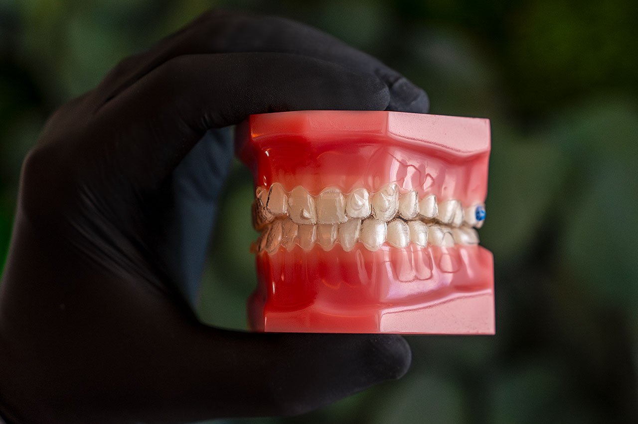 prozirni aparat novog doba