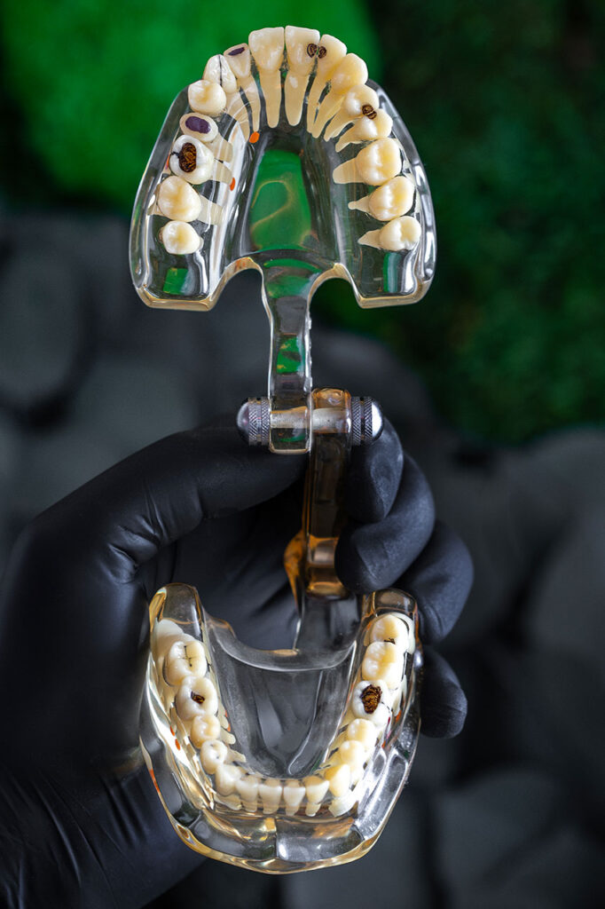 popravak i liječenje zuba